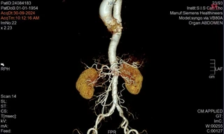 Đau bụng vật vã suốt 3 tuần vì căn bệnh cực hiếm gặp trên toàn thế giới