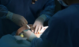 Cô gái biến dạng ngực, cấp cứu vì tiêm chất làm đầy để 'nâng cấp vòng 1'