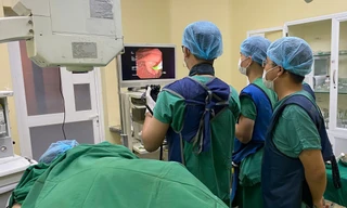 Phát hiện sán lá gan 'khủng' trong ống mật cô gái trẻ