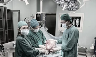 Cứu bé gái mang khối u buồng trứng khổng lồ