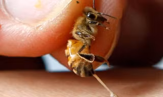 Dùng ong đốt để điều trị ung thư, người phụ nữ phải cắt bỏ cả hai bên ngực
