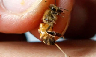 Dùng ong đốt để điều trị ung thư, người phụ nữ phải cắt bỏ cả hai bên ngực