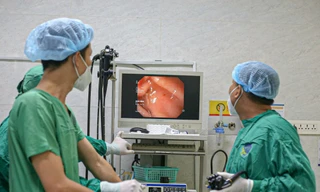 Nuốt đũa để 'thể hiện' trong cuộc nhậu, nam thanh niên thủng ruột phải cấp cứu