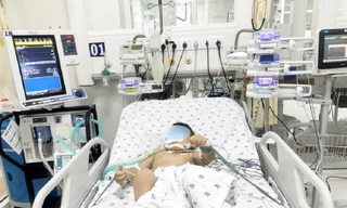 Hai anh em ruột nguy kịch vì bị ong vò vẽ tấn công