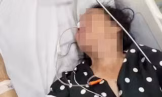 Người phụ nữ mắc bệnh cực hiếm bị nhầm với loạn thần vì tự la hét, cười nói một mình