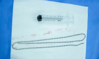 Dùng dây chuyền 'tự sướng', nam thanh niên gặp nạn