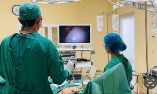 U nang buồng trứng 'tấn công' người trẻ