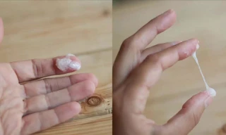 Mắc bệnh lậu sau khi 'trót dại' với nữ nhân viên massage