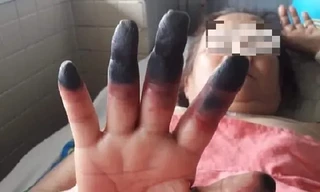 Đau nhức chân tay coi chừng bệnh lý nguy hiểm