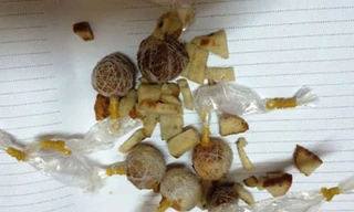 Ăn nhầm bả chó, bệnh nhi 2 tuổi nguy kịch