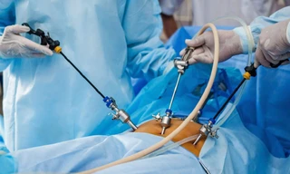 3 'sát thủ' ung thư tiêu hóa nguy hiểm nhất tại Việt Nam