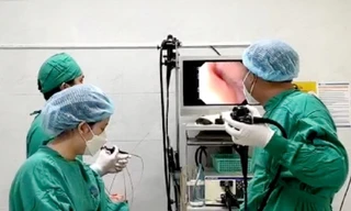 Bệnh nhân thủng dạ dày vì thói quen thường ngày của nhiều người Việt