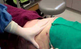 Vụ hút mỡ bụng tử vong: 'Không có sai sót chuyên môn'