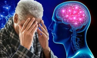 2.800 tỷ USD 'bốc hơi' theo bệnh sa sút trí tuệ