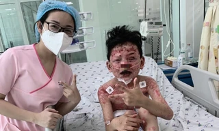 Bé trai 'thập tử nhất sinh' sau khi ăn cua