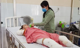 Người phụ nữ mất cả tứ chi vì điện giật khi dùng cây sắt hái xoài cho con