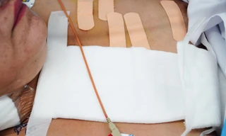 Kịch tính ca phẫu thuật khẩn cứu người phụ nữ bị đâm nhiều nhát