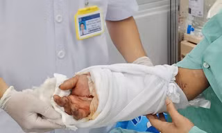 Nam thanh niên bị máy dập lìa cổ tay lúc nửa đêm
