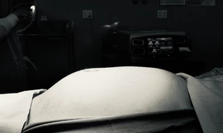 Bụng bé gái phình to nhanh chóng, bác sĩ mổ gấp để lấy khối u khổng lồ