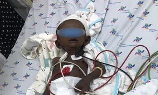 Bị bệnh hiếm gặp, bé gái người Việt da vàng chuyển sang... màu đen