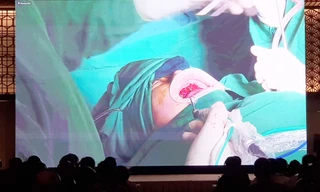 Một chuyên khoa y tế không có bệnh nhân phải ra nước ngoài điều trị