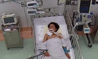 Bị rắn độc tấn công khi ngủ dưới nền nhà, cậu bé 13 tuổi nguy kịch