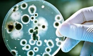 Nhiễm loại vi khuẩn kháng thuốc 'khét tiếng', nữ sinh béo phì suýt tử vong