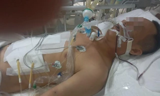 Nhát đâm chí mạng khiến cơ thể nạn nhân 'khô máu'