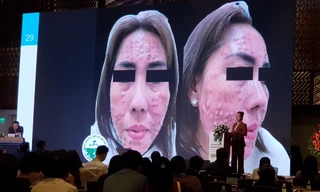 Làm đẹp từ 'bác sĩ' thẩm mỹ tay ngang, hàng loạt bệnh nhân gặp tai biến nghiêm trọng