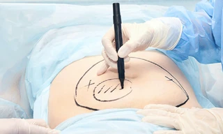 Bệnh viện 'ém' thông tin sự cố y khoa sau phẫu thuật thẩm mỹ