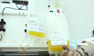 Đang khỏe mạnh, bé gái đột ngột bị liệt vì bệnh hiếm gặp