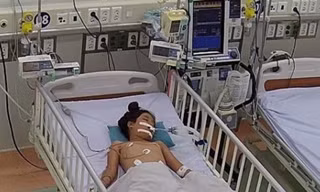 Bé gái nguy kịch vì bị rắn độc cắn nhưng lại nhờ thày lang 'hút nọc độc'