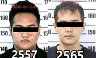 Tay buôn ma tuý Sarahat Sawangjaeng trước và sau khi phẫu thuật