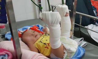 Bé trai bị bố bạo hành chấn thương nặng.