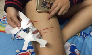 Tội phạm rạch đùi nữ sinh từng xuất hiện ở TPHCM.