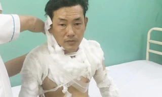 Vụ 9X tẩm xăng lên người để cướp ngân hàng: Nhân viên bí mật nhấn chuông báo động