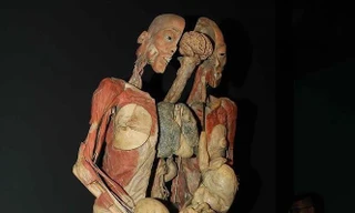 Tận thấy các mẫu vật xác người gây ám ảnh tại triển lãm ở TPHCM