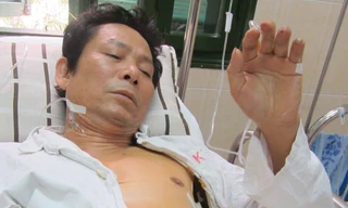 Ông Khải đang điều trị tại BV Việt Đức