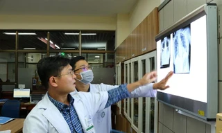 Người phụ nữ Hà Nội mang khối u 4 kg, chèn 'bẹp dí' phổi, đẩy tim chạy ngược lên trên