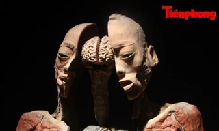 Triển lãm xác người ở TPHCM: Về phương diện y khoa thì rất ý nghĩa