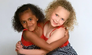 Kì lạ hai bé gái sinh đôi khác màu da