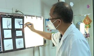 Mù mắt, co giật, tắc động mạch não vì tiêm filler làm đẹp mũi