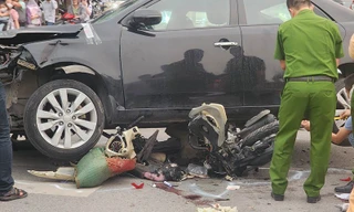 Bé 3 tuổi bị đa chấn thương trong vụ ô tô đâm hàng chục xe máy vừa trải qua ca đại phẫu