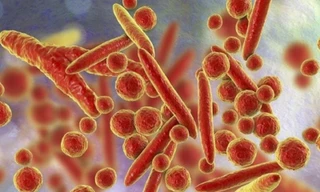 Bộ Y tế thông tin về các trường hợp mắc bệnh chưa rõ nguyên nhân tại Liên bang Nga