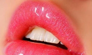 Chăm sóc môi mùa lạnh