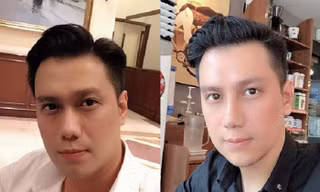 Vì sao Việt Anh vội vàng phẫu thuật thẩm mỹ ngay sau khi ly hôn?