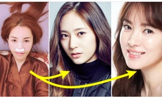 Quế Vân gây sốc khi chi 200 triệu phẫu thuật mũi giống Song Hye Kyo