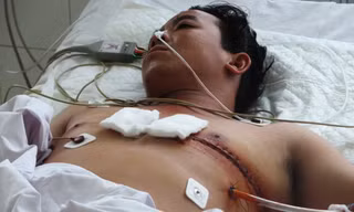Bệnh nhân Nguyễn Hoàng Minh đã dần hồi phục.