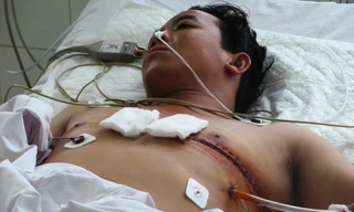 Bệnh nhân Nguyễn Hoàng Minh đã dần hồi phục.