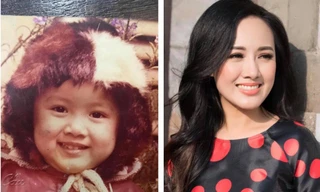 BTV Hoài Anh nói gì về tin đồn sửa mũi?